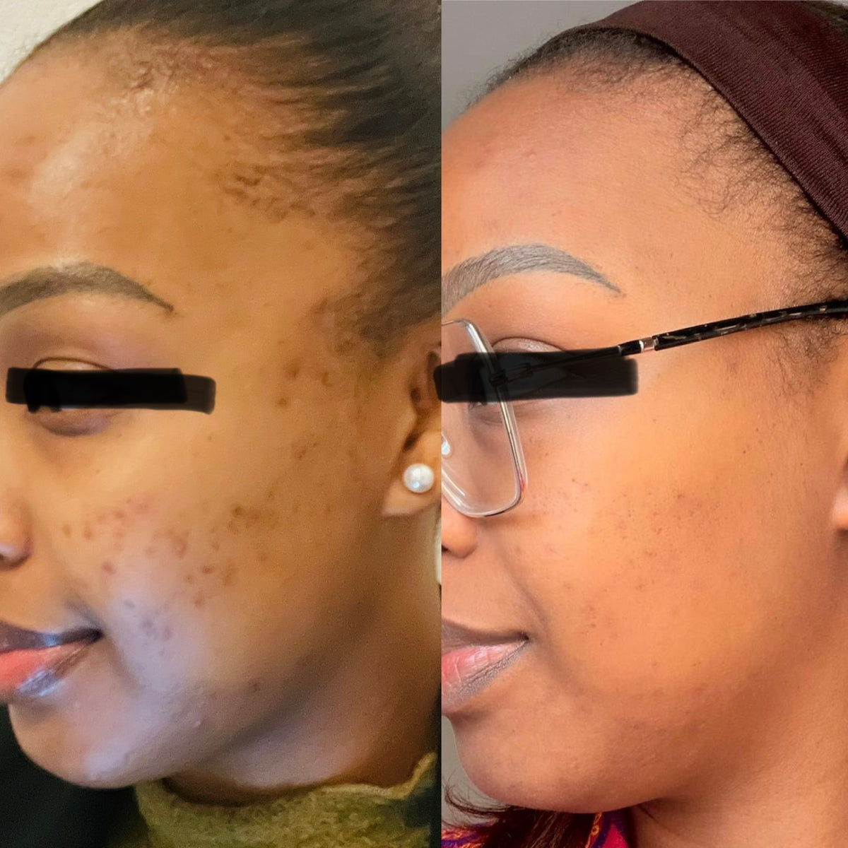 Natural Retinol Alternative Face Oil