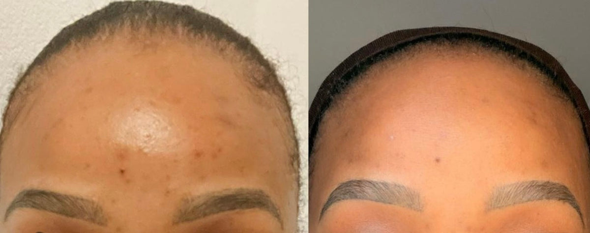 Natural Retinol Alternative Face Oil