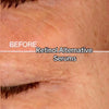 Retinol Alternative Serum - smooth, even skin without the drama