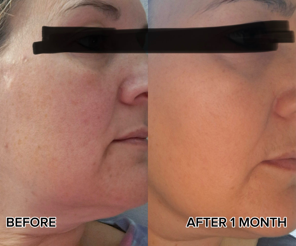 Natural Retinol Alternative Face Oil